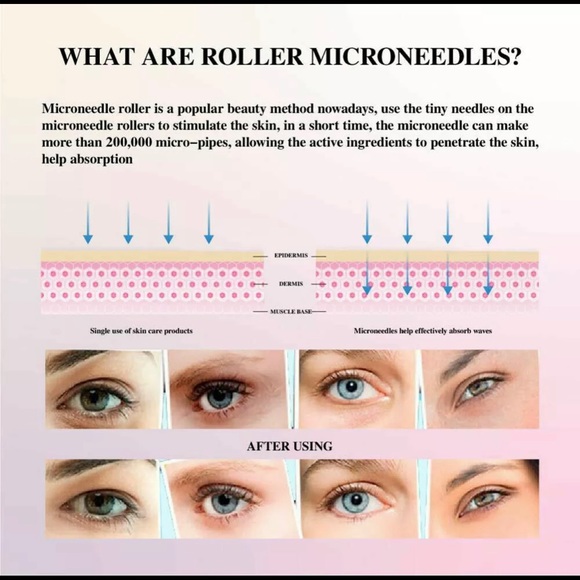 Derma Roller/Micro Needless - Picture 3 of 11